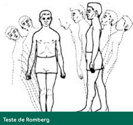 Проба ромберга. Проба ромберга атаксия. Поза ромберга. Поза ромберга неустойчива.